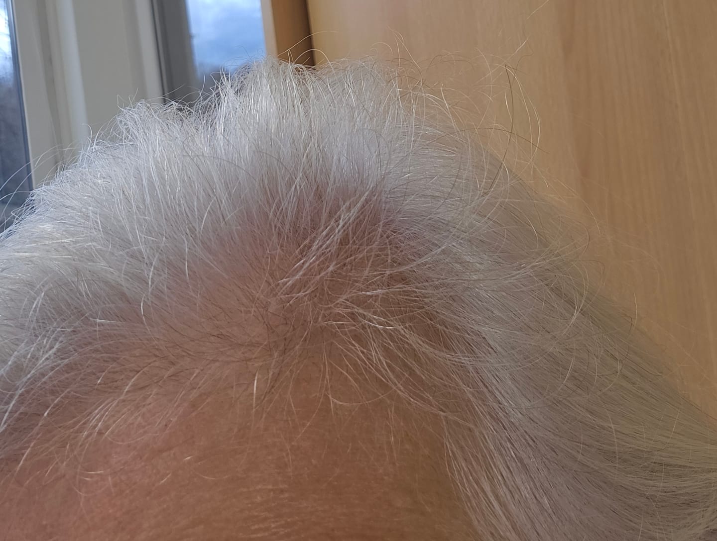Customer photo review of Advanced Pterostilbene