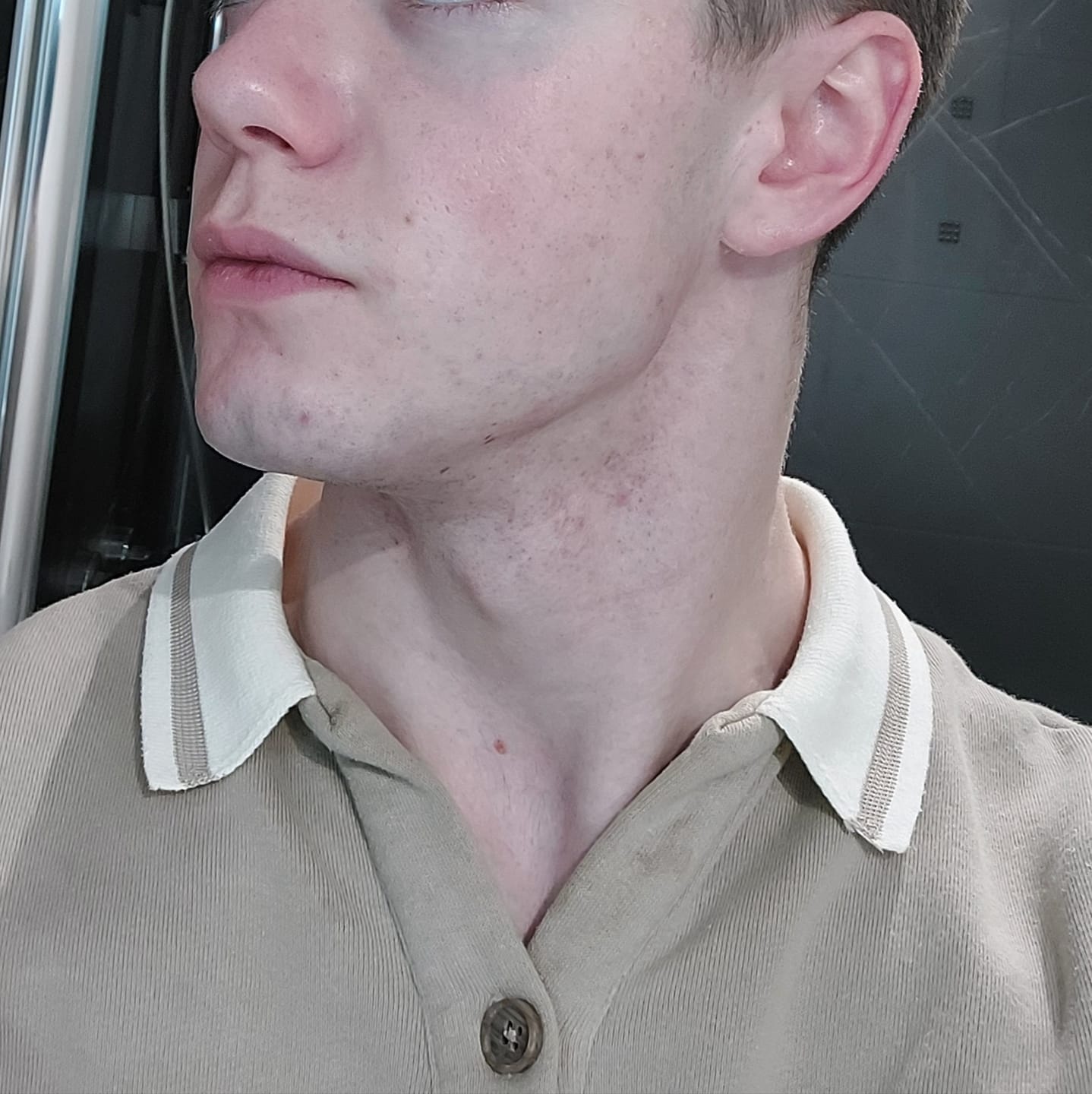 Customer photo review of Retinol Serum 30ml