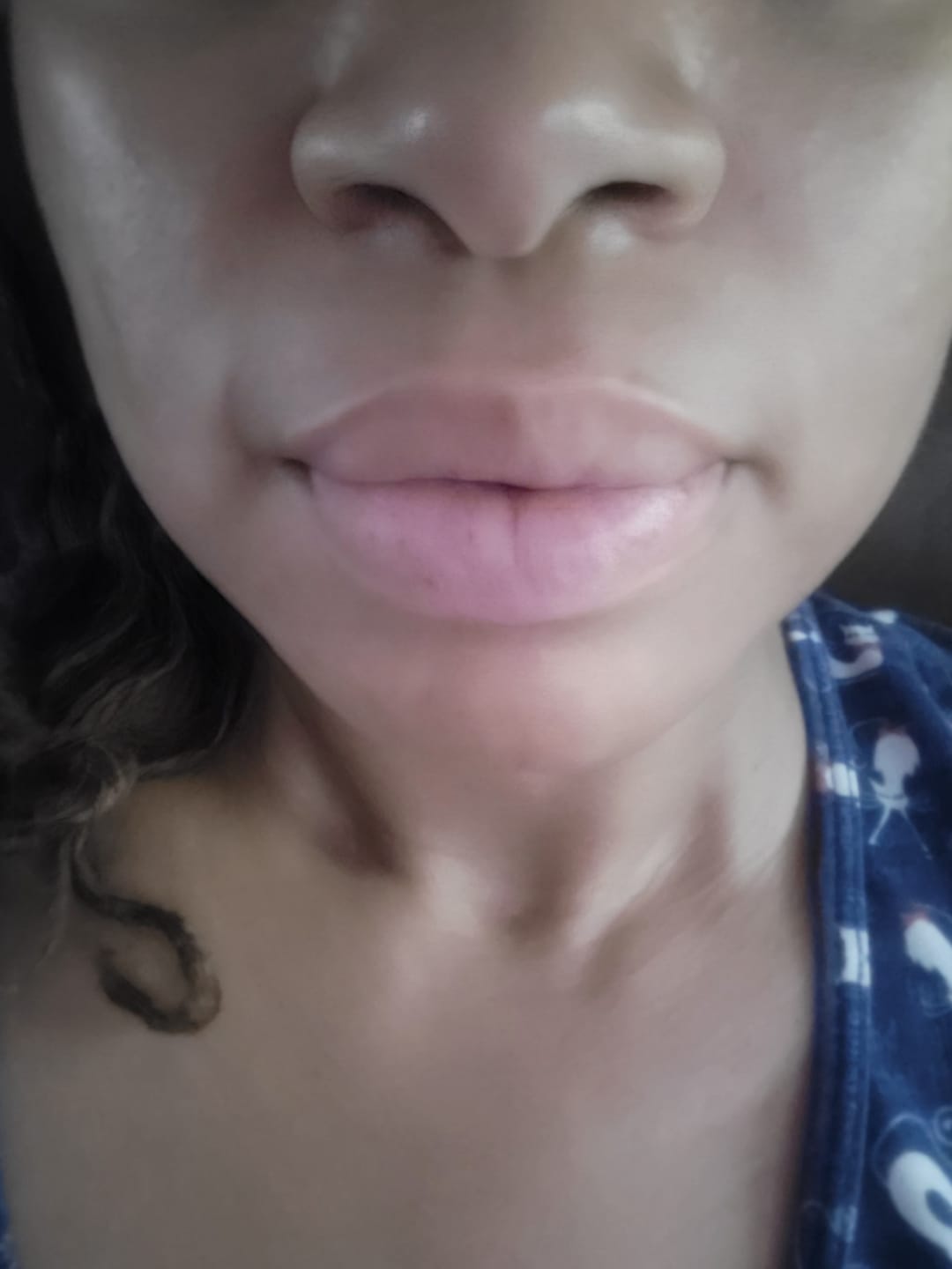 Customer photo review of Lips Lightening Cream For Men and Women (Results in 5 Days or Less)