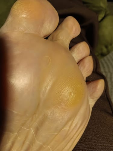 Customer photo review of Ultra Methylene Blue Capsules