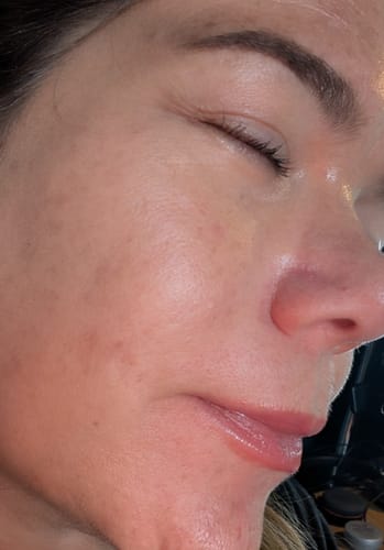 Customer photo review of Seb Natural Calming Serum