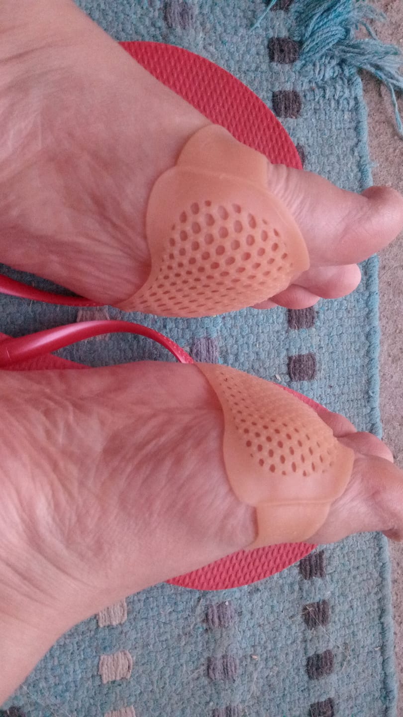 Customer photo review of Almohadillas Metatarsianas de Silicona