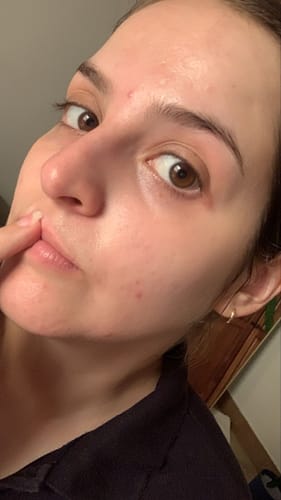 Customer photo review of Relief Sun Aqua - Fresh Rice + B5 SPF50+ PA++++