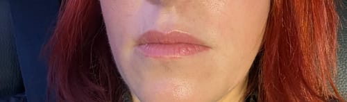 Customer photo review of Sérum de Exosomas Ultra Rejuvenecedor con Bioexosomas de Bakuchiol