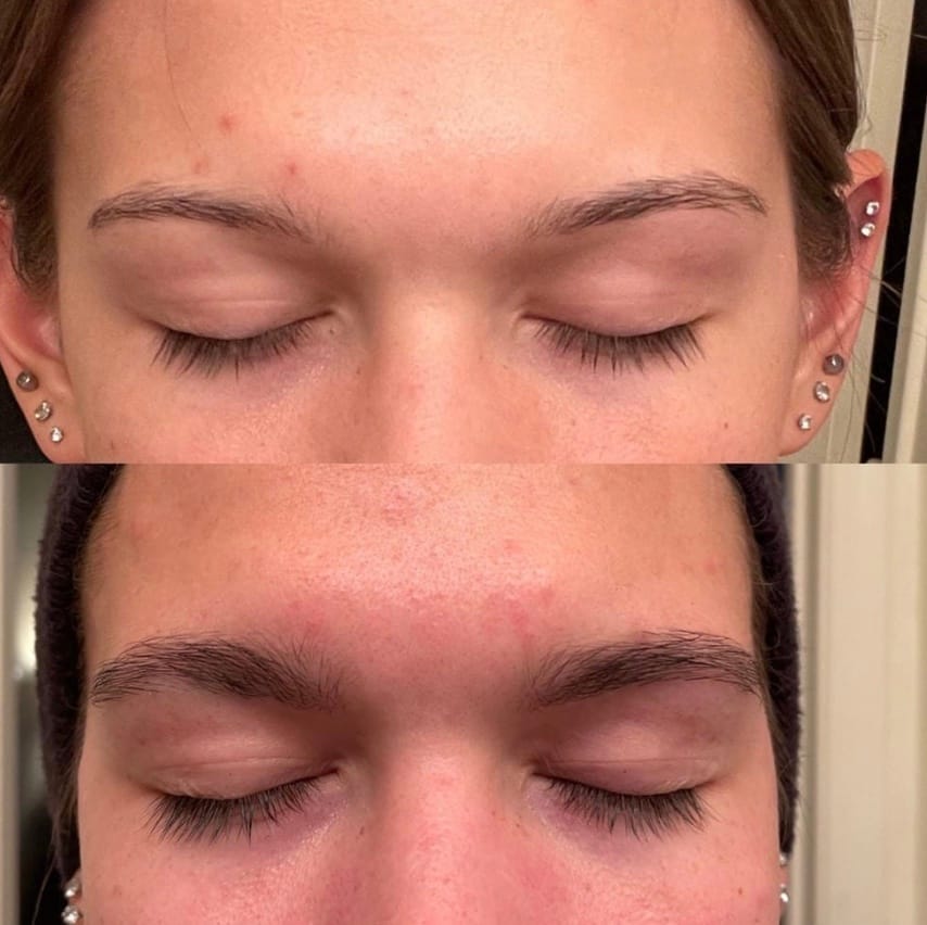 Customer photo review of IZABELL ROLLER - רולר לצמיחת הגבות מחדש