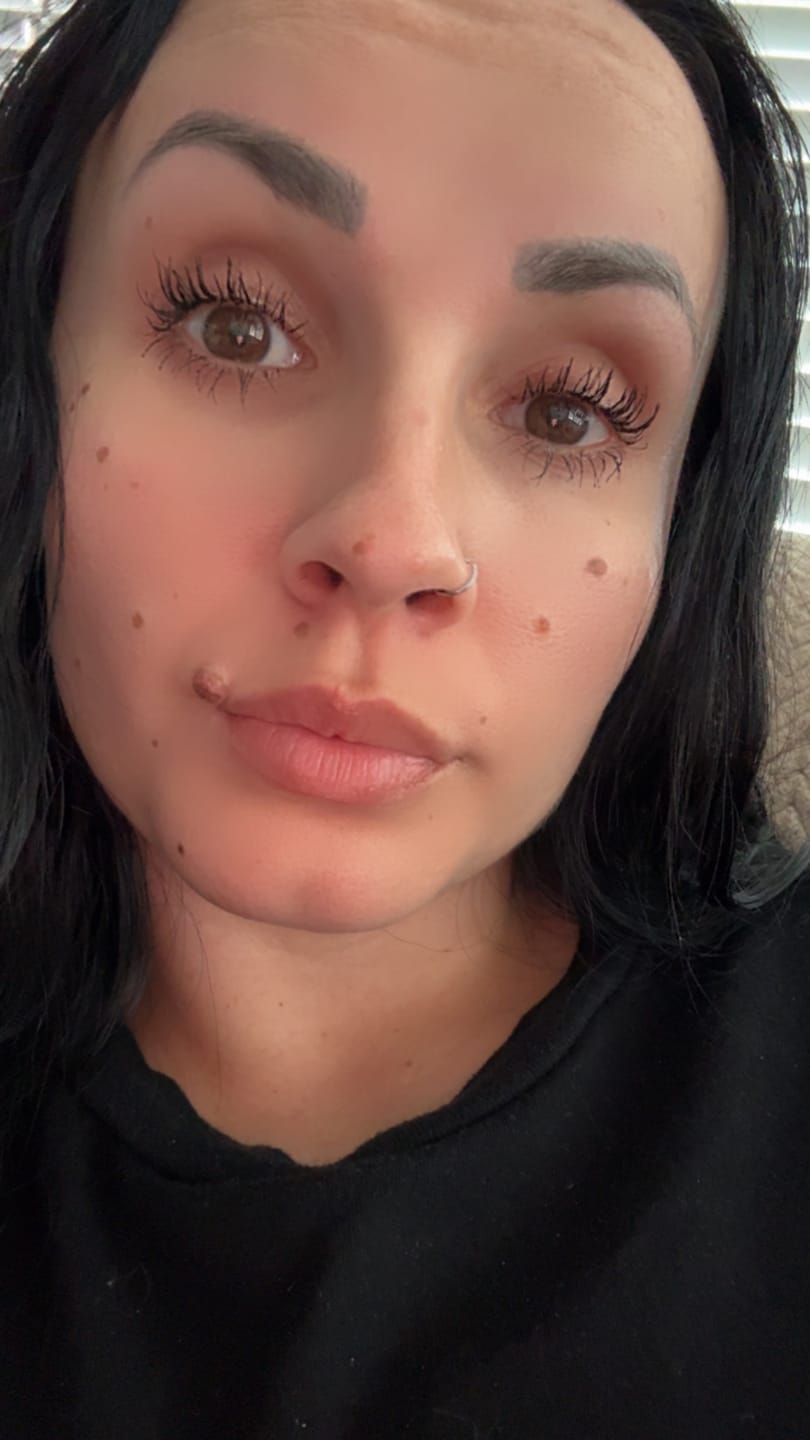 Customer photo review of LASH GROWTH SERUM