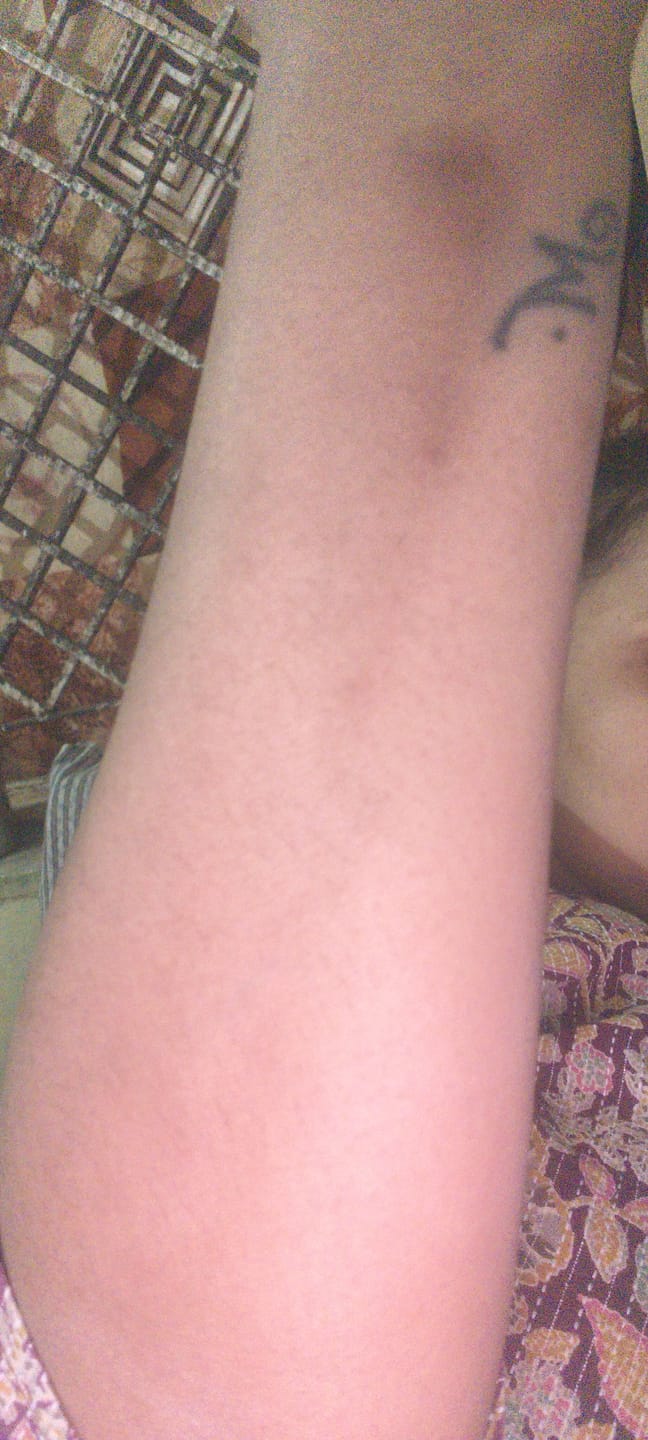 Customer photo review of Magic Soap + Free Exfoliating Body Glove