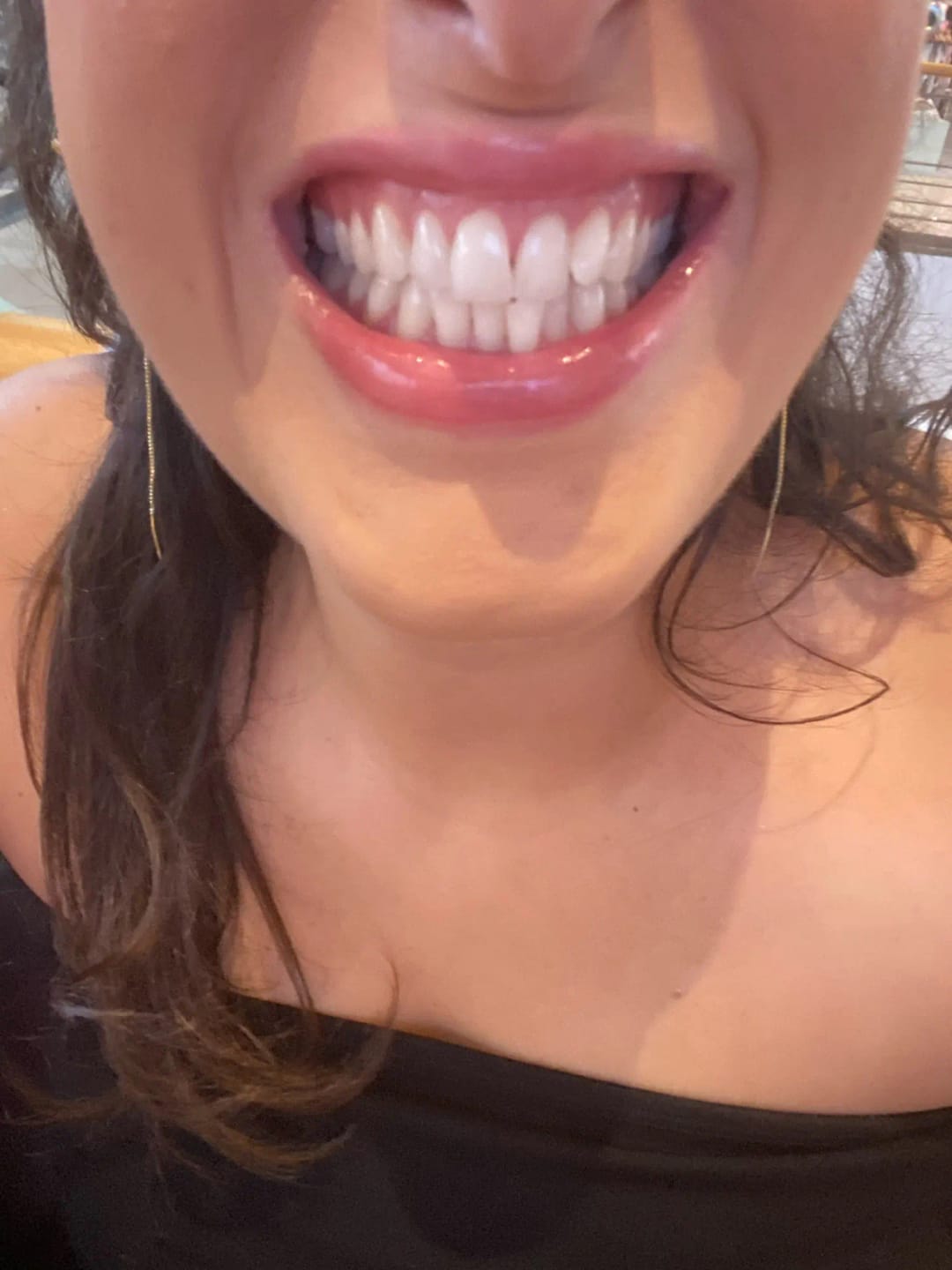 Customer photo review of Niacinamide Whitening Toothpaste