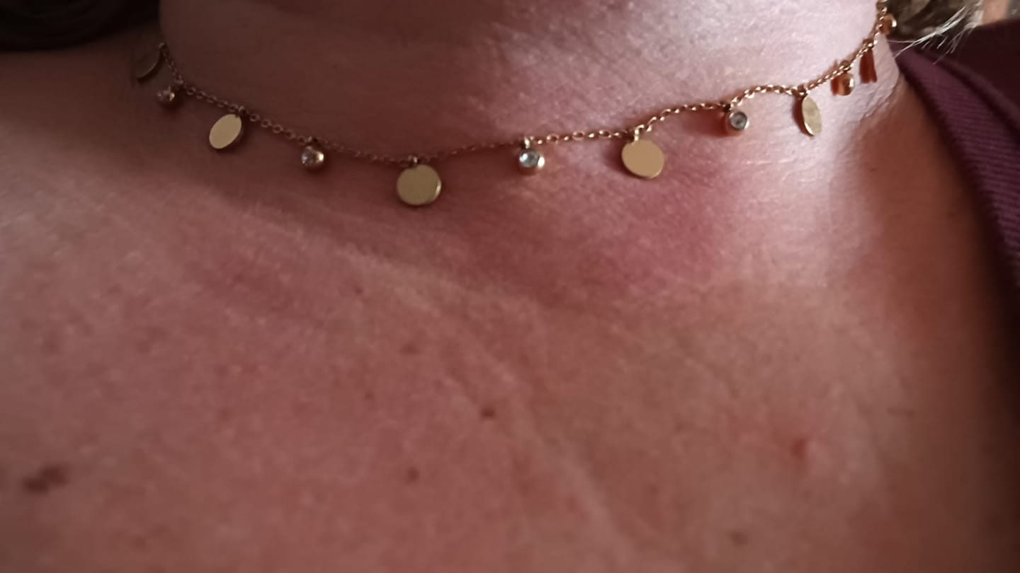 Customer photo review of Lantisor Golden Drops