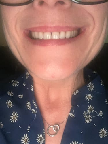 Customer photo review of Toothpaste Starter Pack