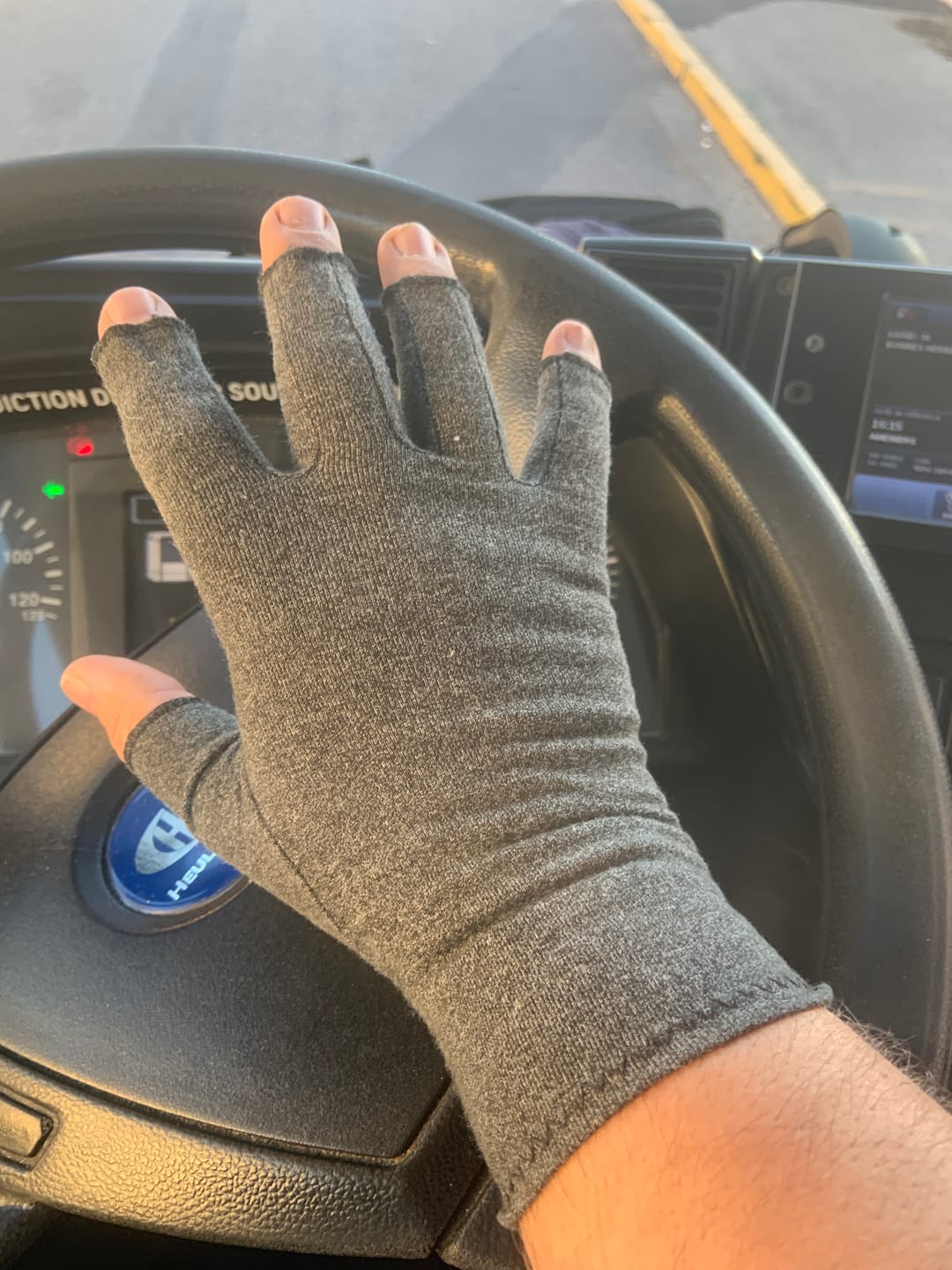 Customer photo review of Gants de Compression