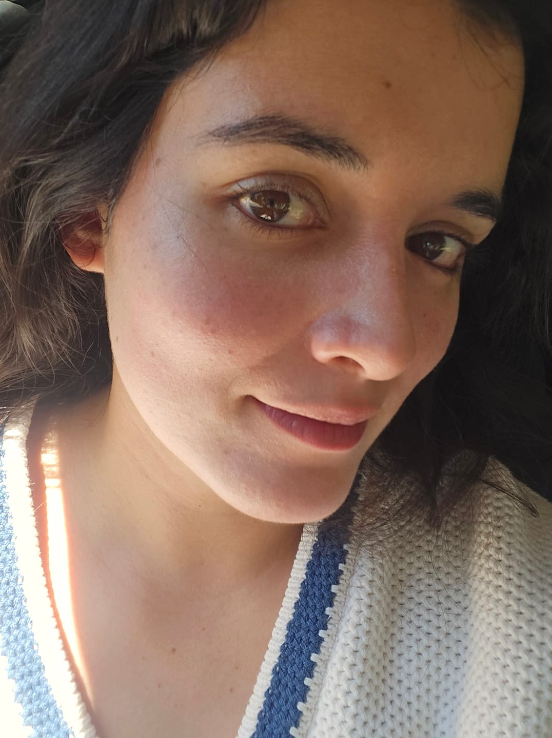 Customer photo review of Delicate Touch - Emulsión Recuperadora | Para pieles con dermatitis, rosácea o sensibilidad