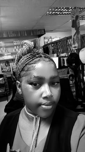 Customer photo review of Minoxidil High Strength (5%) SOLUTION, 3x60ml pack