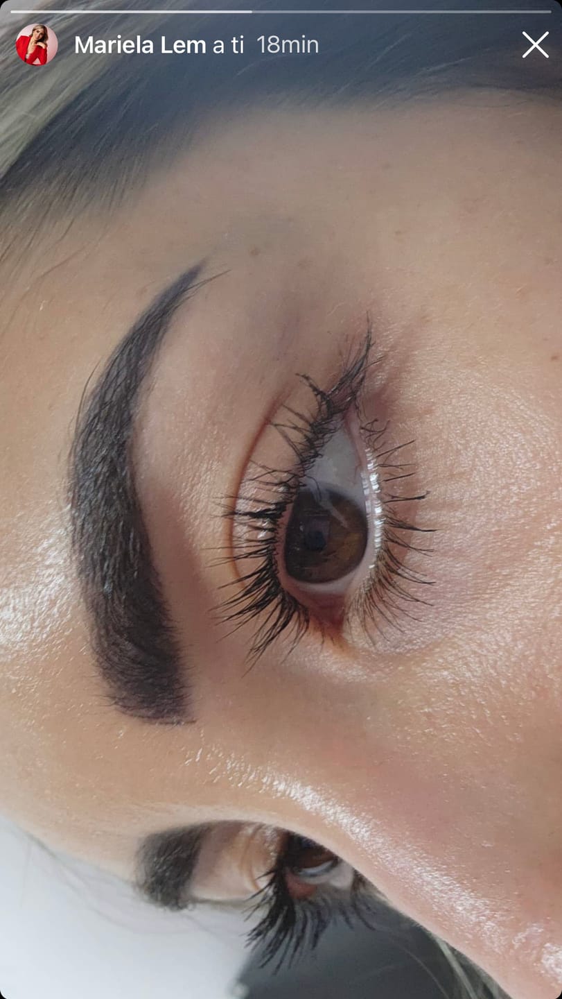 Customer photo review of Suero para crecimiento de pestañas y cejas