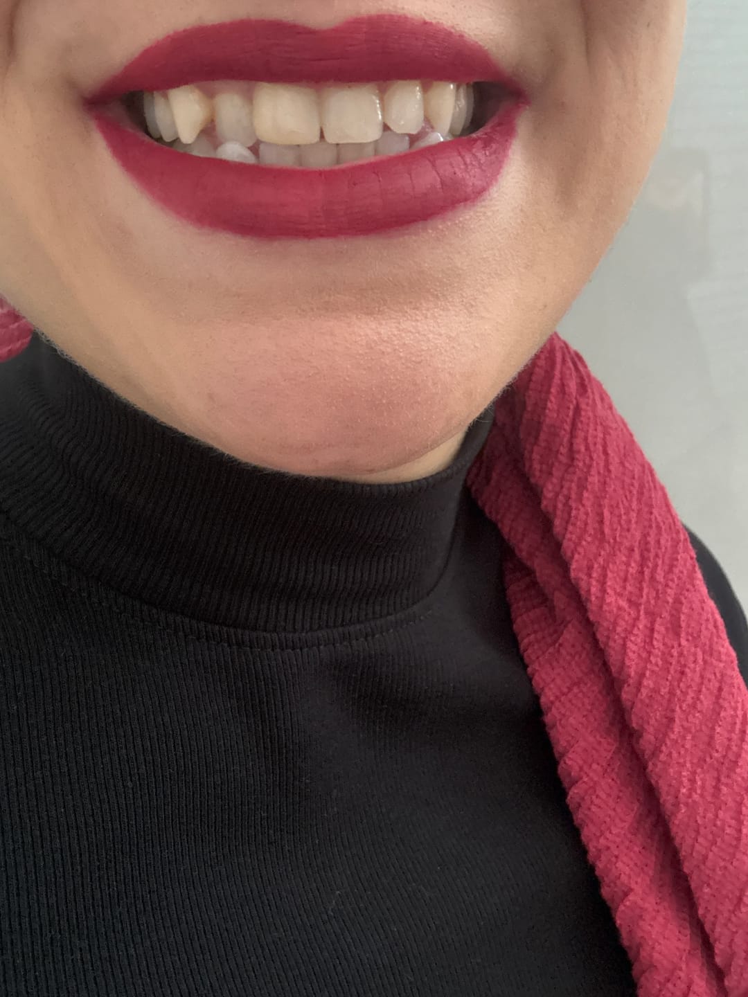 Customer photo review of אודמים עמידים bonic