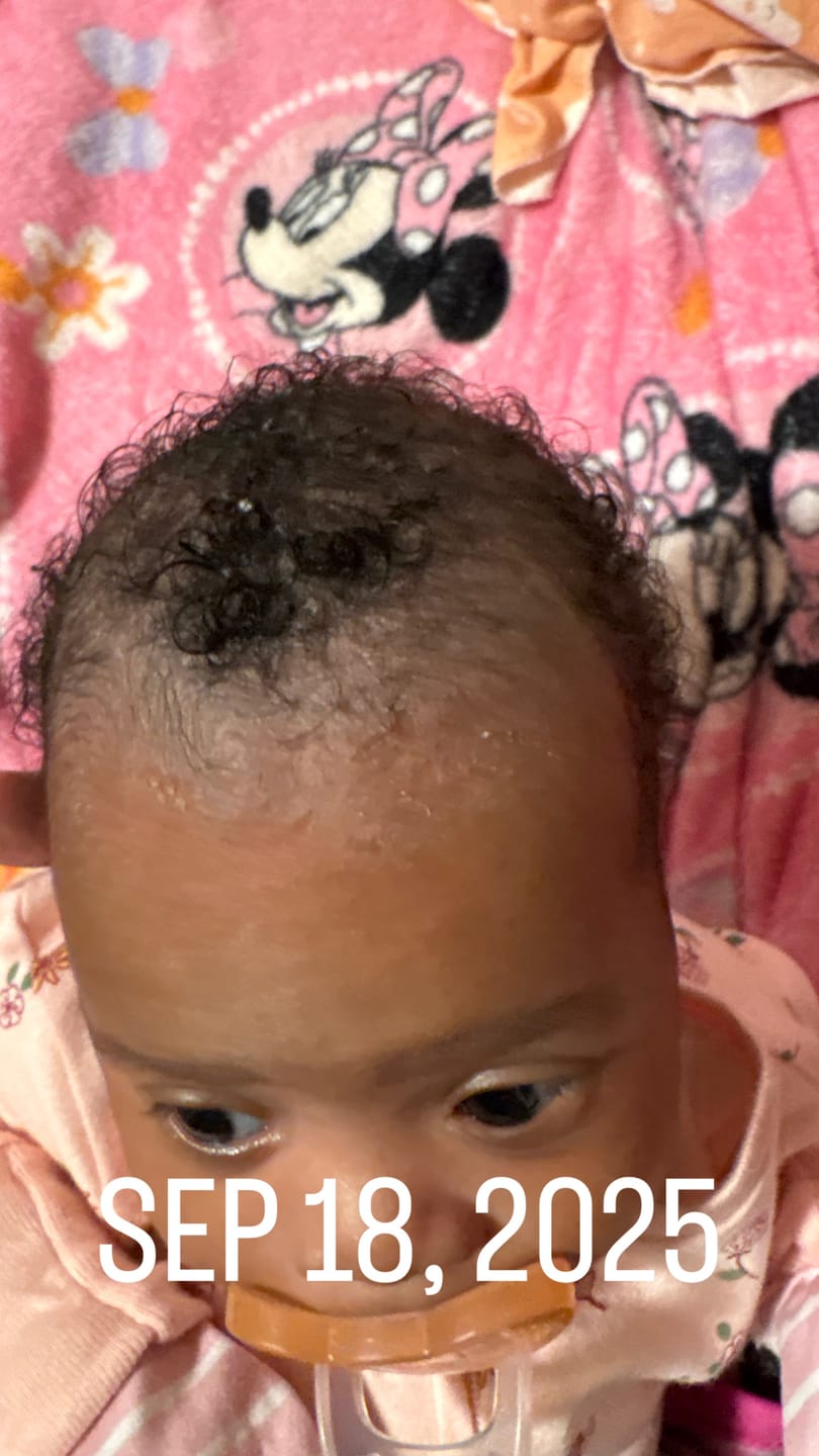 Customer photo review of Avocado Oil Stimulating Hair Growth Serum
