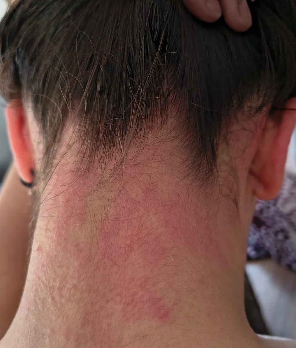 Customer photo review of Delicate Touch | Emulsión Recuperadora | Calmante