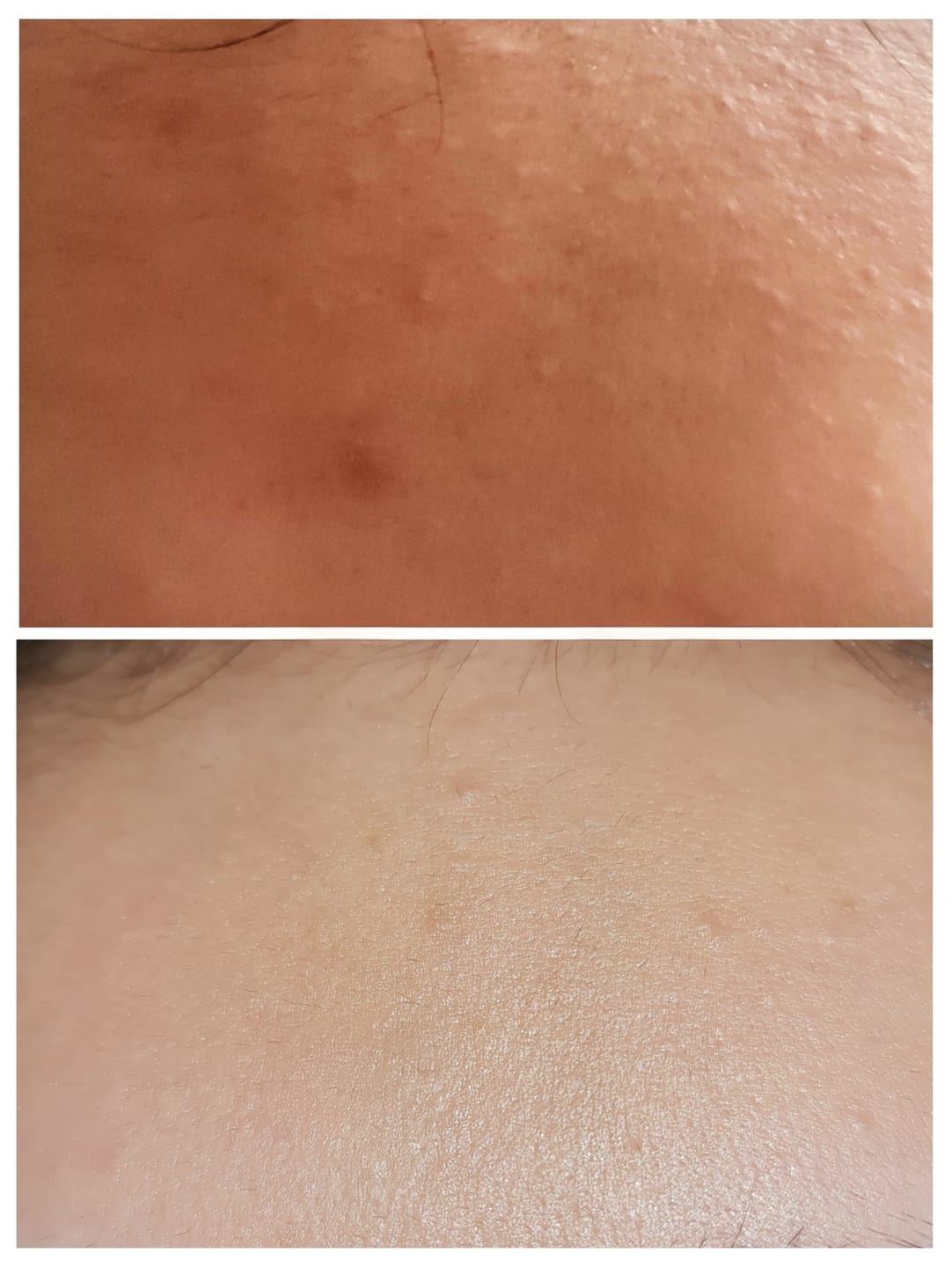 Customer photo review of Skin Rescue Mist