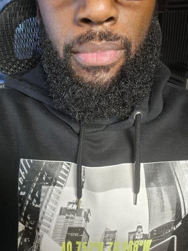 Customer photo review of Seb Natural Calming Serum