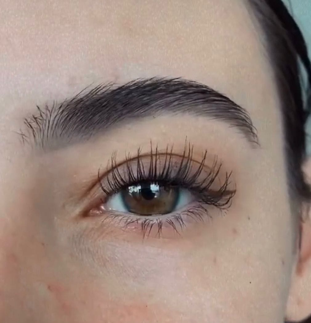 Customer photo review of Suero para crecimiento de pestañas y cejas