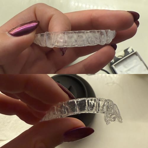 Customer photo review of Dental Pod Pro