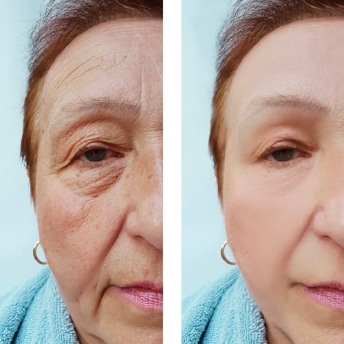 Customer photo review of CollaGlow - 30 Tage Kollagen-Kur