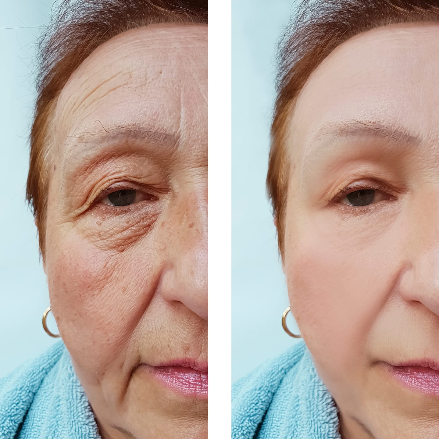 Customer photo review of CollaGlow - 30 Tage Kollagen-Kur