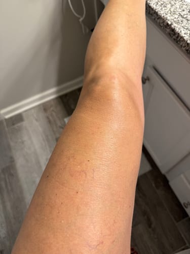 Customer photo review of Besque™ Magic Body Oil - 100ml