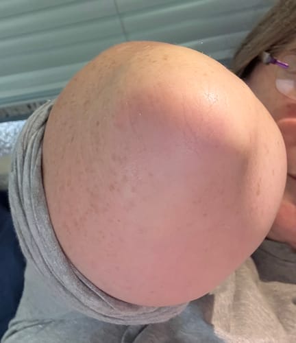 Customer photo review of Body Serum