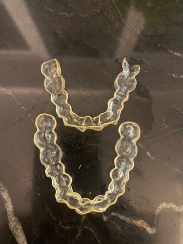 Customer photo review of Dental Pod Pro