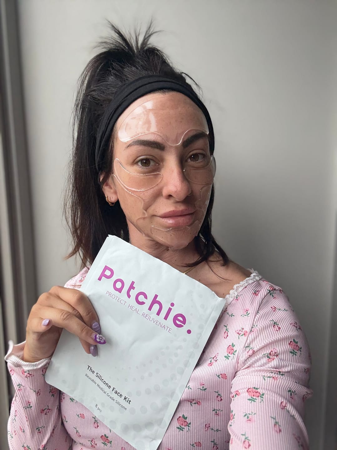 Customer photo review of Full Face Silicone Patch Kit - Reusable 22 Times