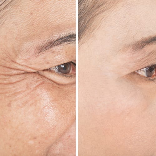 Customer photo review of CollaGlow - 30 Tage Kollagen-Kur
