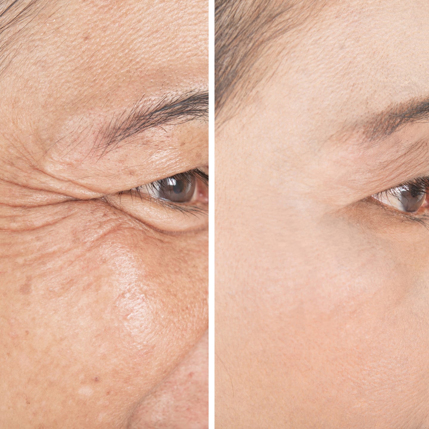 Customer photo review of CollaGlow - 30 Tage Kollagen-Kur