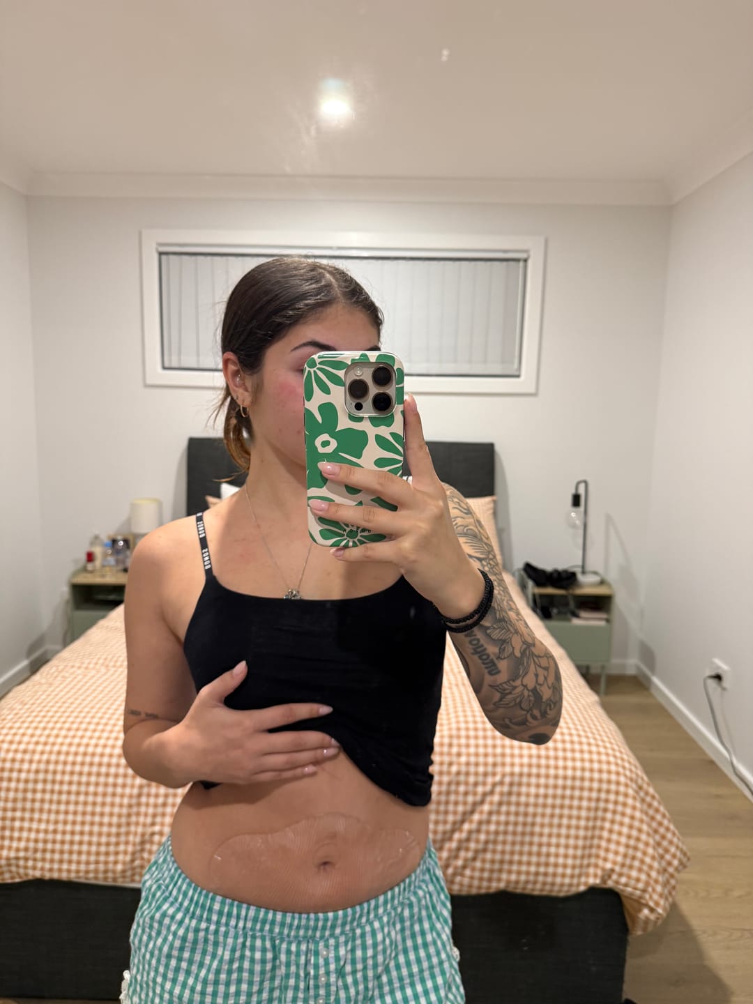 Customer photo review of Silicone Belly Patch - Reusable 22 Times
