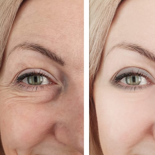 Customer photo review of CollaGlow - 30 Tage Kollagen-Kur