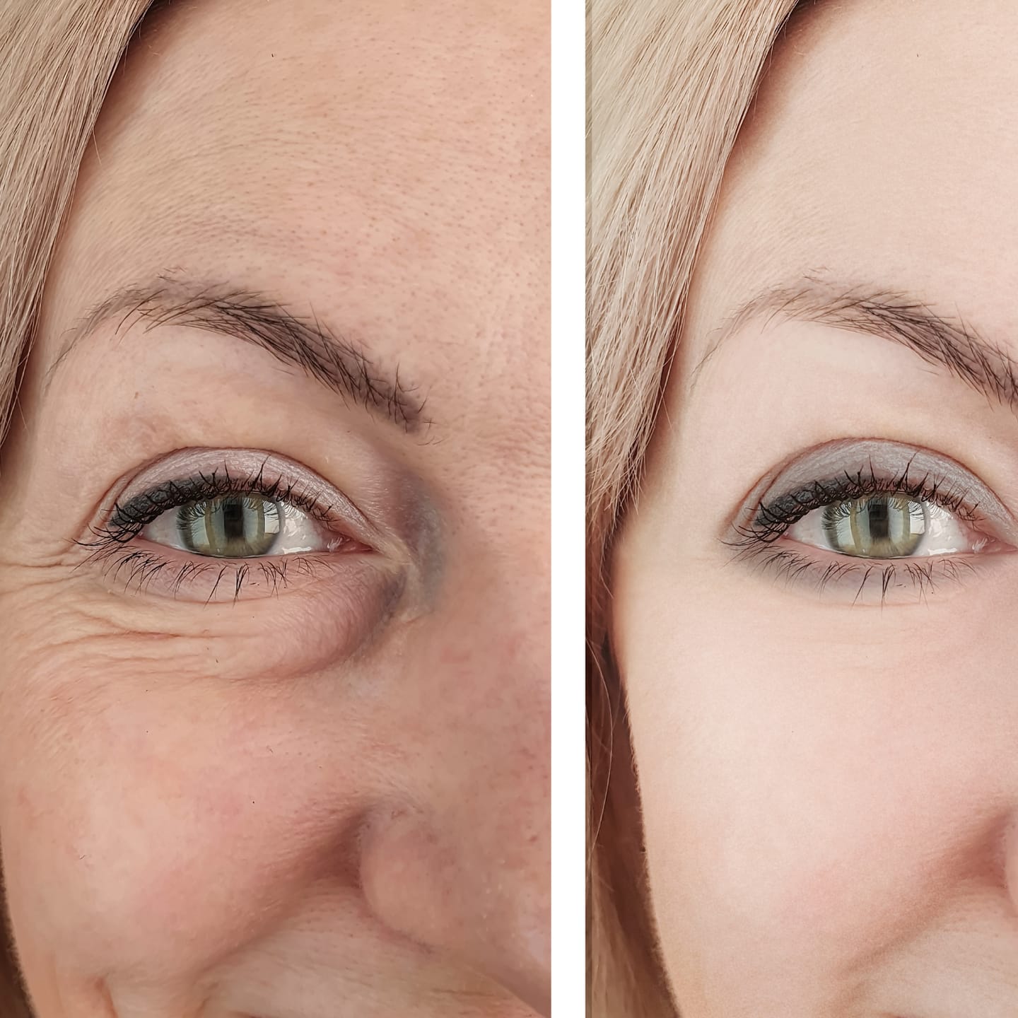 Customer photo review of CollaGlow - 30 Tage Kollagen-Kur