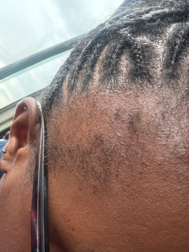 Customer photo review of NOVIFUL Hair Growth Serum - 1 PACK