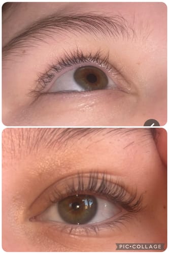 Customer photo review of The Ultimate Lash Growth Starter Kit