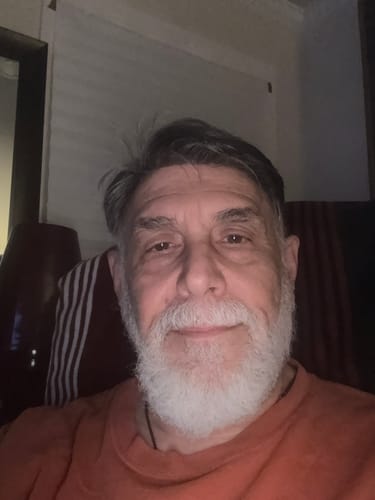 Customer photo review of Men Hair System Extra Light Density V-loop 0.03mm Ultra-thin skin base Sage|No-shine under Lights, Blends Well with Your Skin