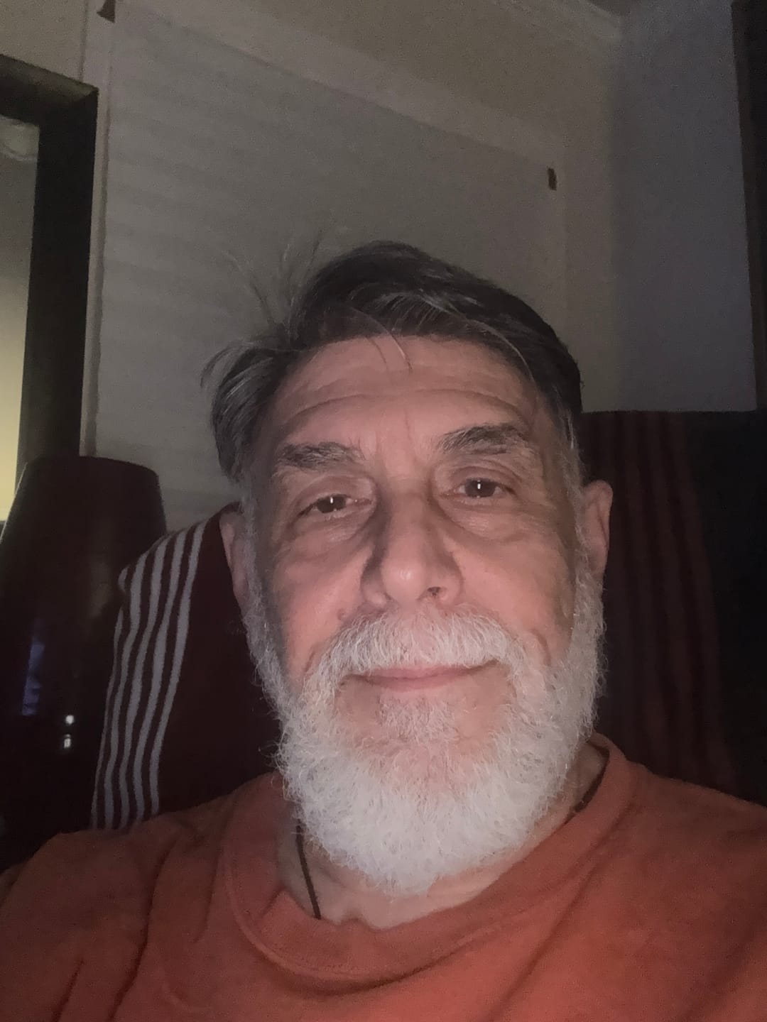 Customer photo review of Men Hair System Extra Light Density V-loop 0.03mm Ultra-thin skin base Sage|No-shine under Lights, Blends Well with Your Skin