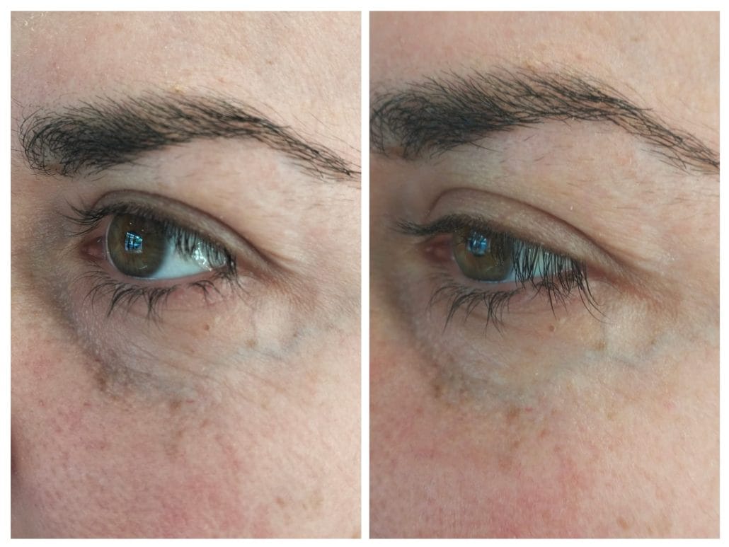 Customer photo review of Anti-ojeras y Bolsas Dr. Retinol