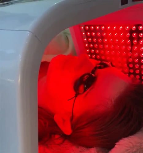 Customer photo review of Friend LED Light Therapy Device