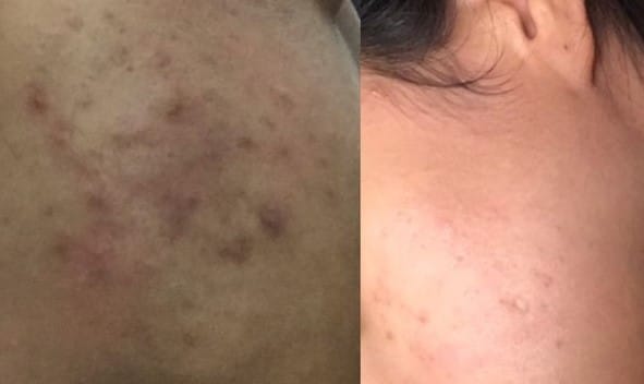 Customer photo review of Ultra Whitening Serum