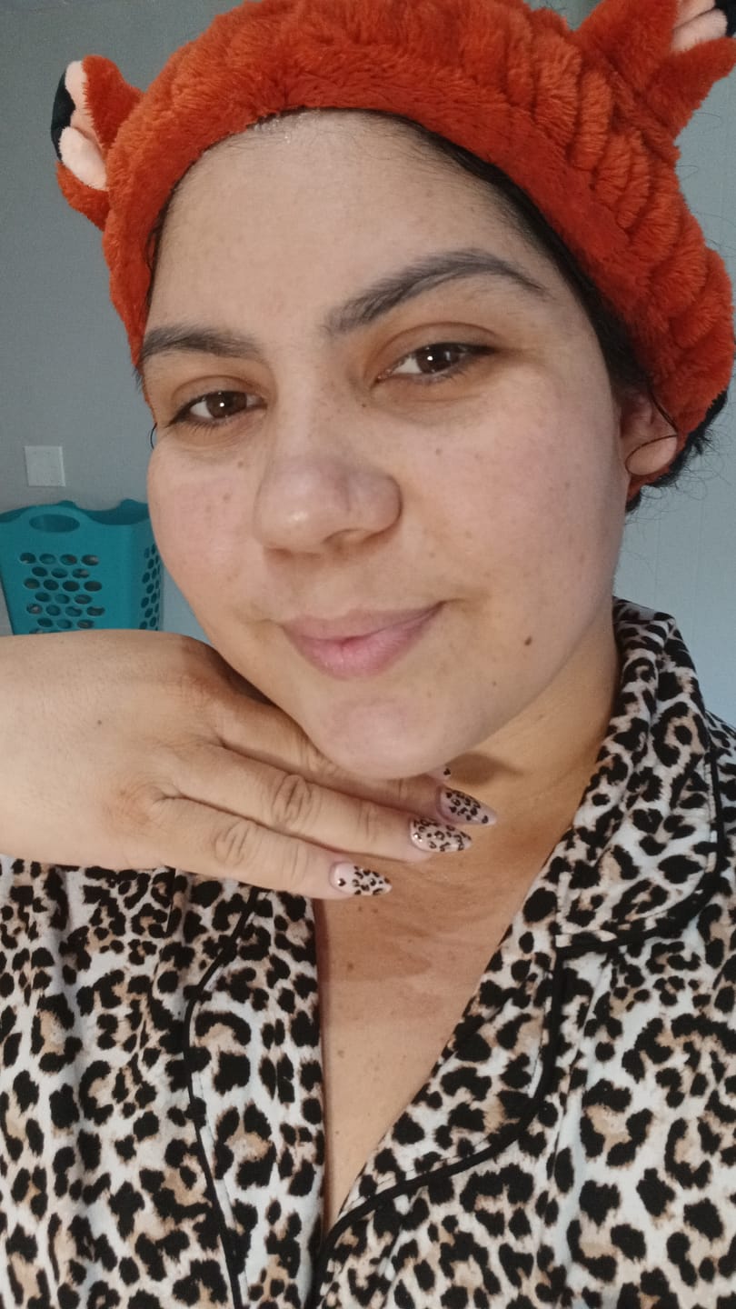 Customer photo review of INIA FLARE Microcurrent Facial Device