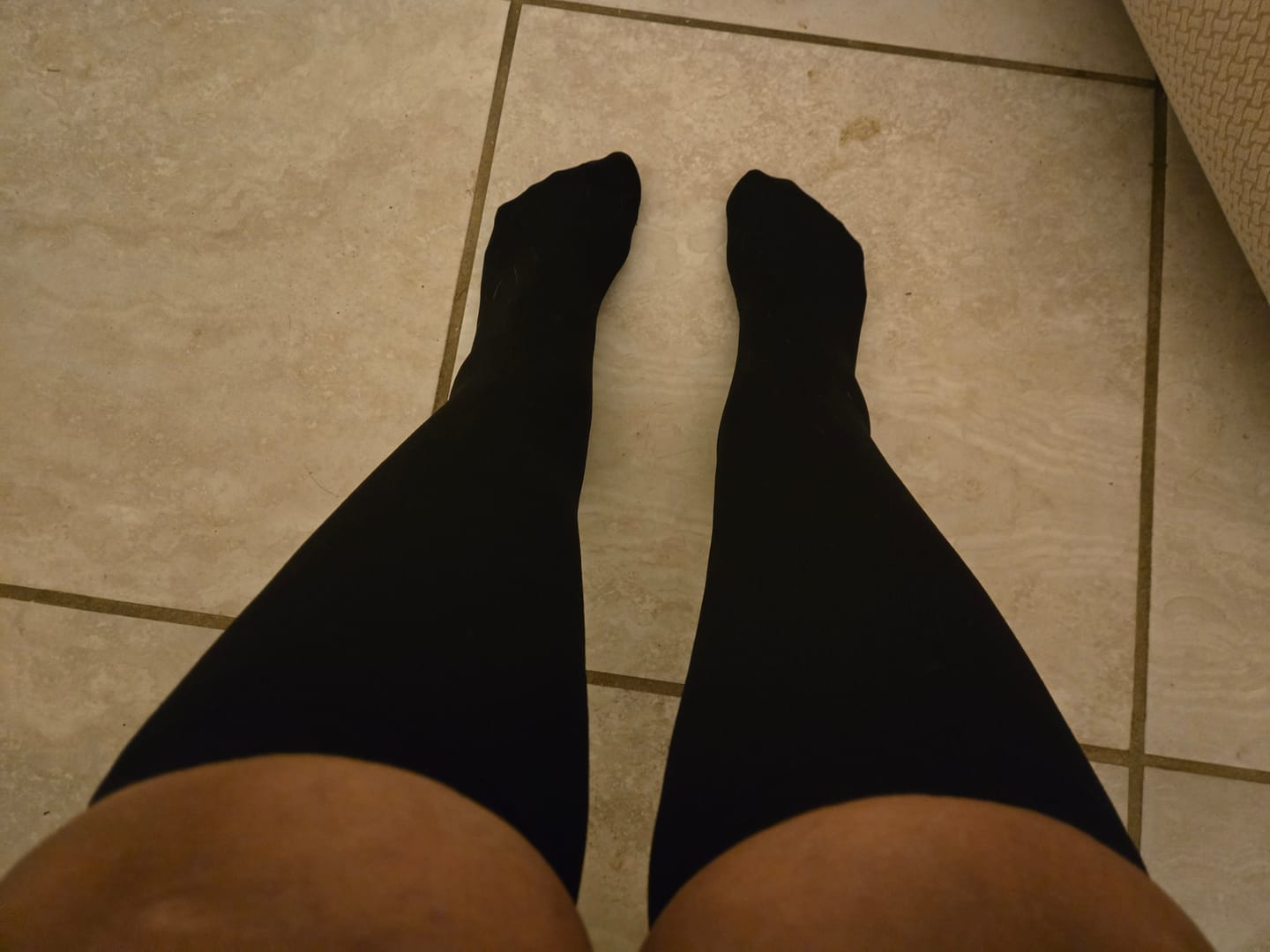 Customer photo review of Everstride™ Advanced Wide Compression Socks For Pain Relief