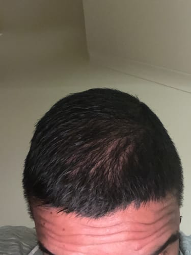 Customer photo review of Seb Natural Calming Serum
