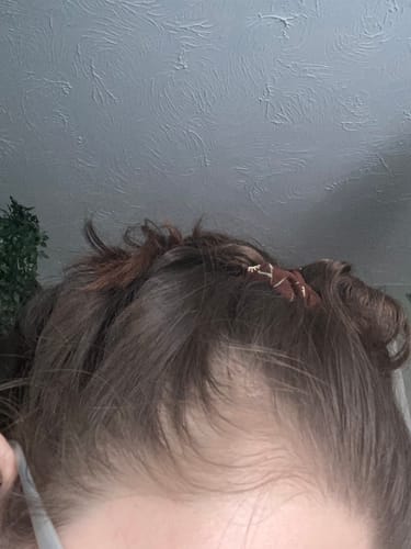 Customer photo review of VITAFOAM ™ Hair Growth Formula