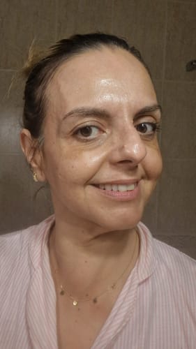 Customer photo review of Sérum de Exosomas Ultra Rejuvenecedor con Bioexosomas de Bakuchiol