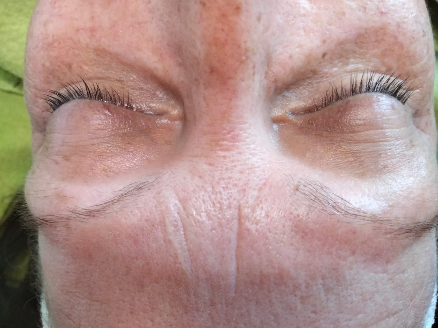 Customer photo review of BROWCOCA!NE - Augenbrauenserum