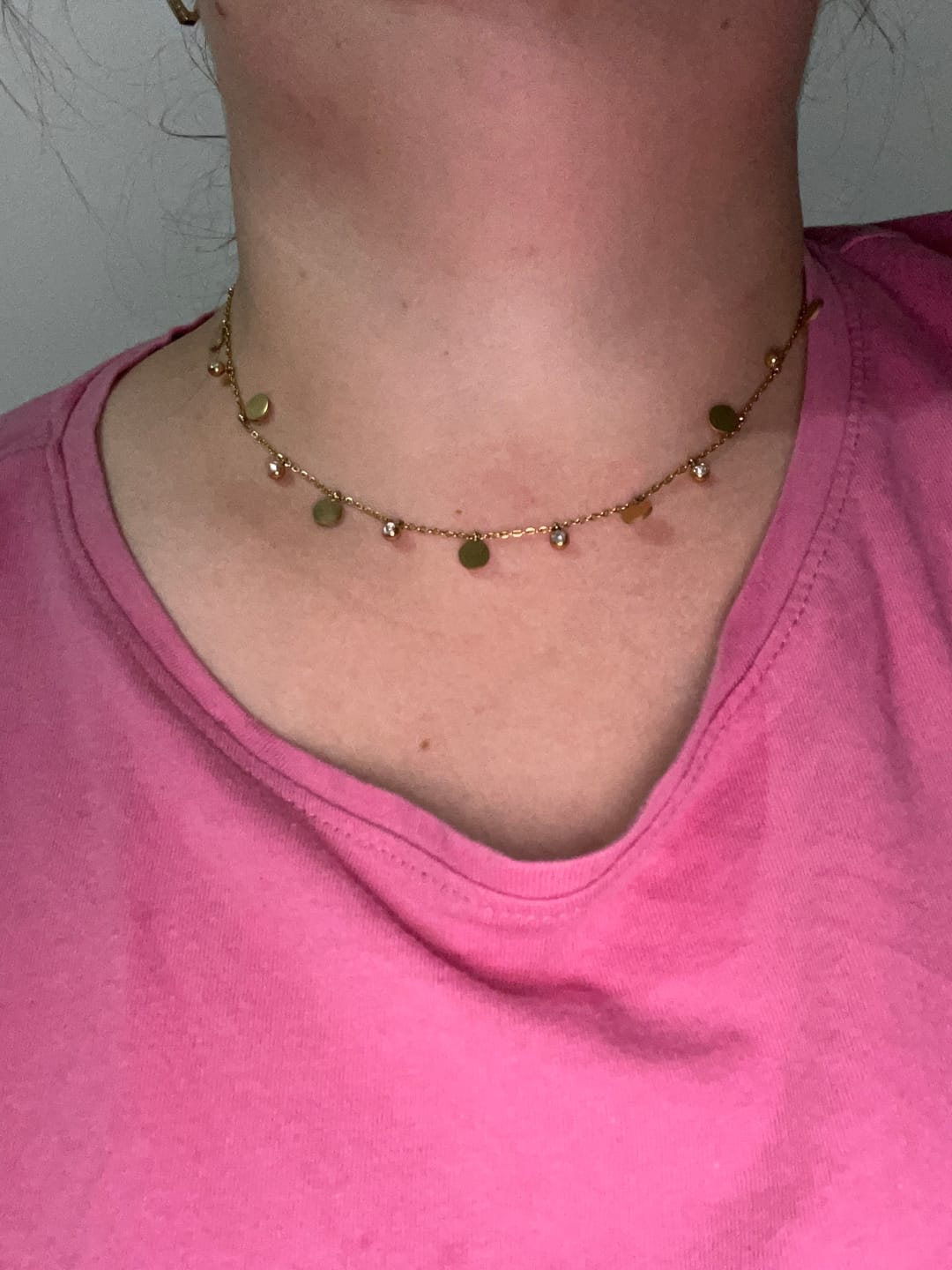 Customer photo review of Lantisor Golden Drops